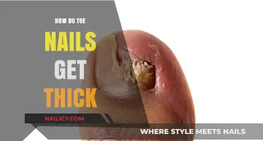 Understanding Thick Toenails: Causes and Effective Treatments