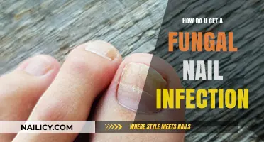 Understanding and Preventing Fungal Nail Infections: A Comprehensive Guide