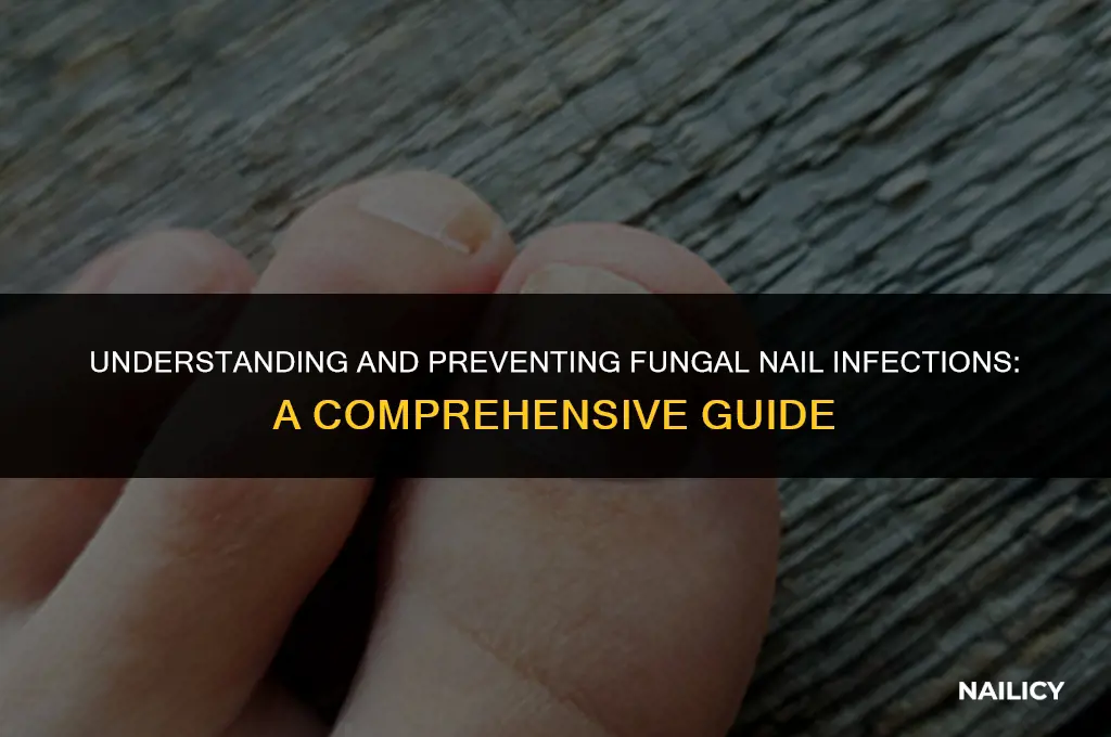 how do u get a fungal nail infection