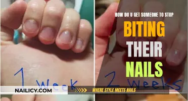 Breaking the Habit: Strategies to Help Someone Stop Nail Biting