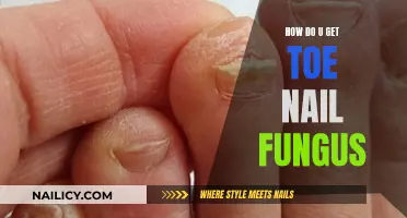 Understanding Toenail Fungus: Causes, Symptoms, and Effective Treatments
