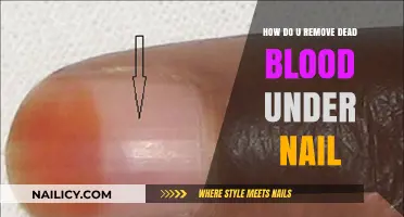 Get Rid of Blood Under Nails Fast