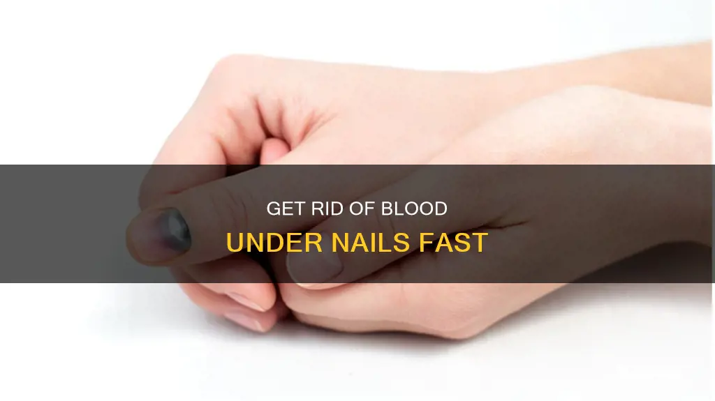 how do u remove dead blood under nail