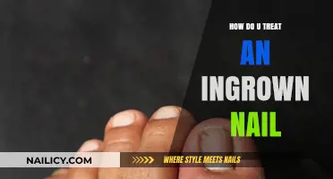 Effective Ways to Treat and Prevent Painful Ingrown Toenails at Home