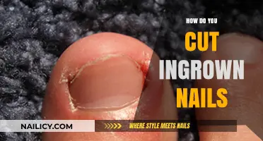Expert Tips to Cut Ingrown Nails Safely