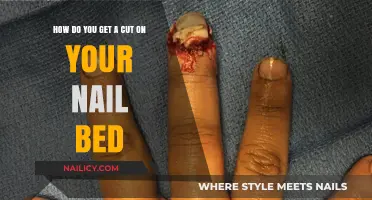 Quick Tips to Treat and Prevent Nail Bed Cuts