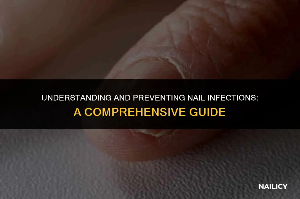 how do you get a nail infection