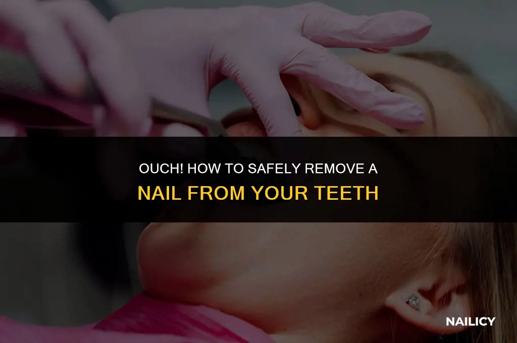 how do you get a nail out of your teeth