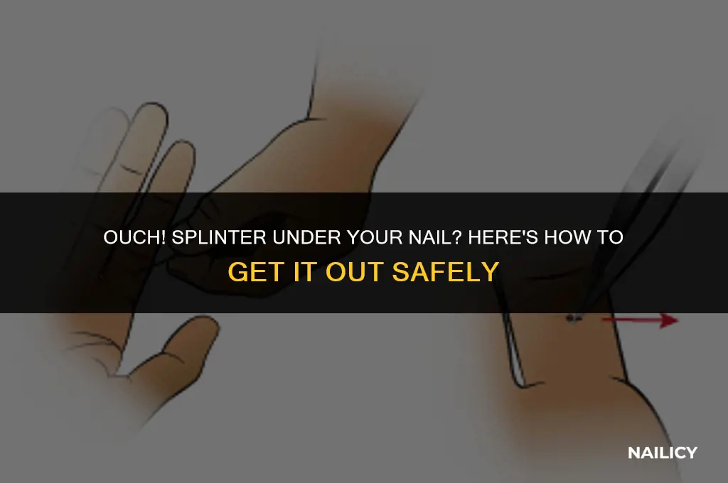 how do you get a splinter from under your nail