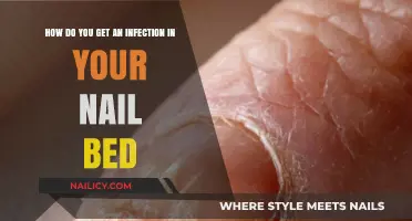 Understanding Nail Bed Infections: Causes, Symptoms, and Treatment