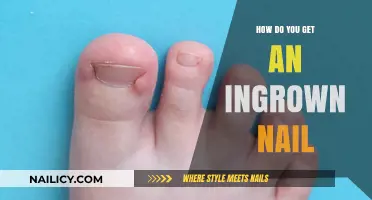 Understanding Ingrown Nails: Causes, Prevention, and Treatment