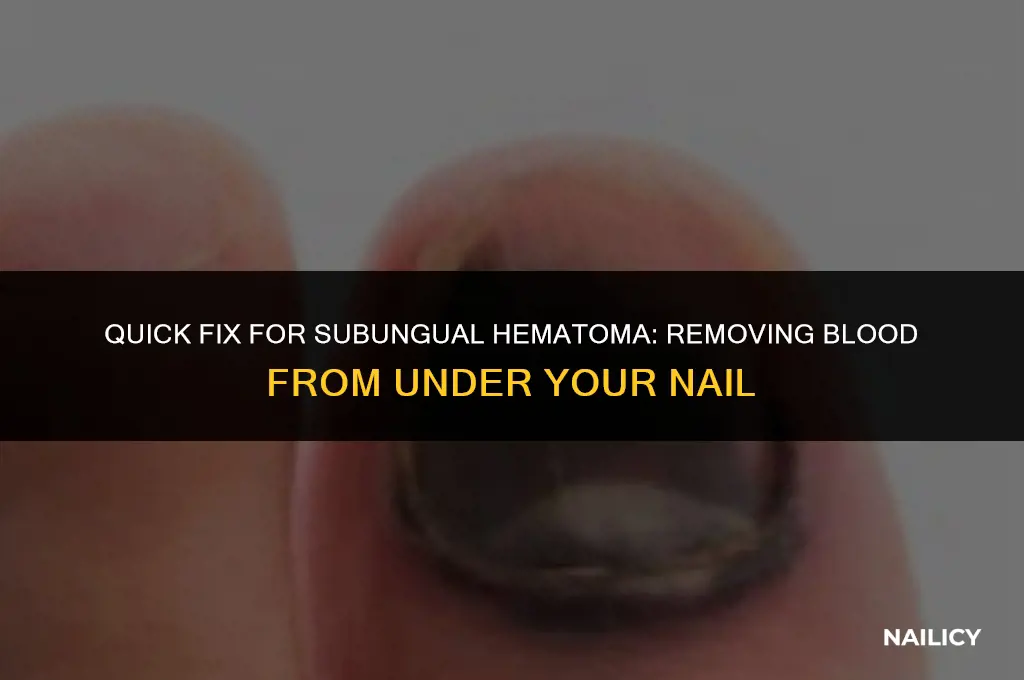 how do you get blood out from under your nail