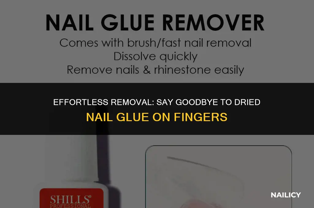 how do you get dried nail glue off your fingers