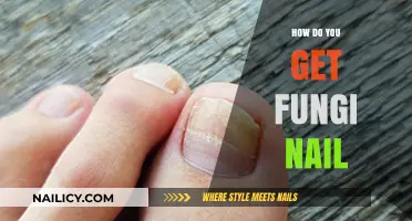 Understanding and Treating Fungal Nail Infections: A Comprehensive Guide