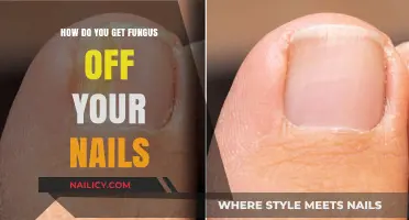 Banish Nail Fungus: Effective Remedies for Healthy Nails