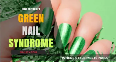 Unveiling the Mystery: How to Get Green Nail Syndrome