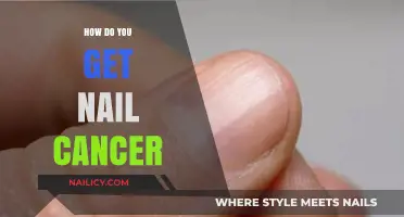 Understanding Nail Cancer: Causes, Symptoms, and Prevention Tips