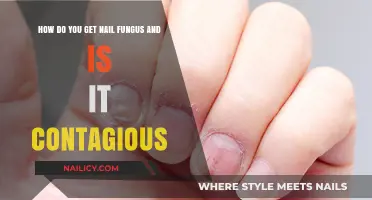 Understanding Nail Fungus: Causes, Contagion, and Prevention Tips