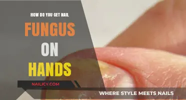 Understanding Nail Fungus: Causes and Prevention for Healthy Hands