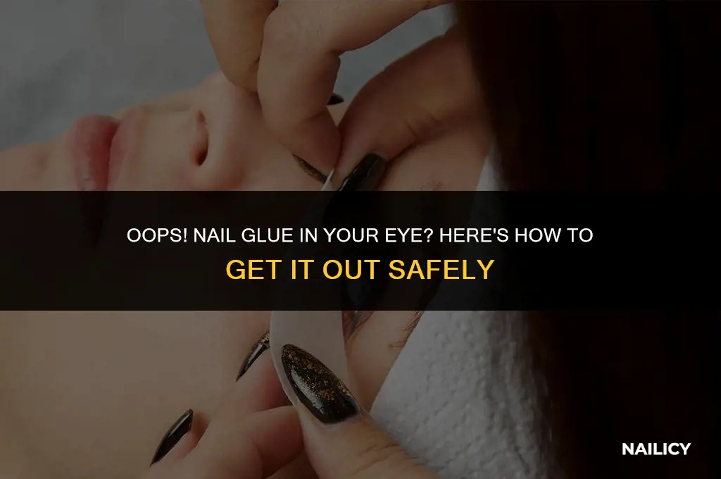 how do you get nail glue out of your eye