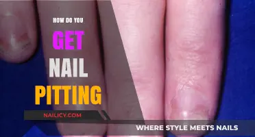 Understanding Nail Pitting: Causes and Effective Treatments