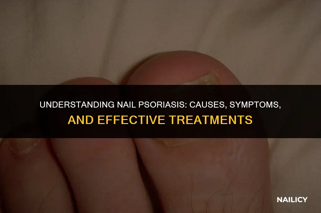 how do you get nail psoriasis