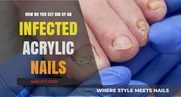 Bye-Bye Infection: A Guide to Treating Acrylic Nail Infections