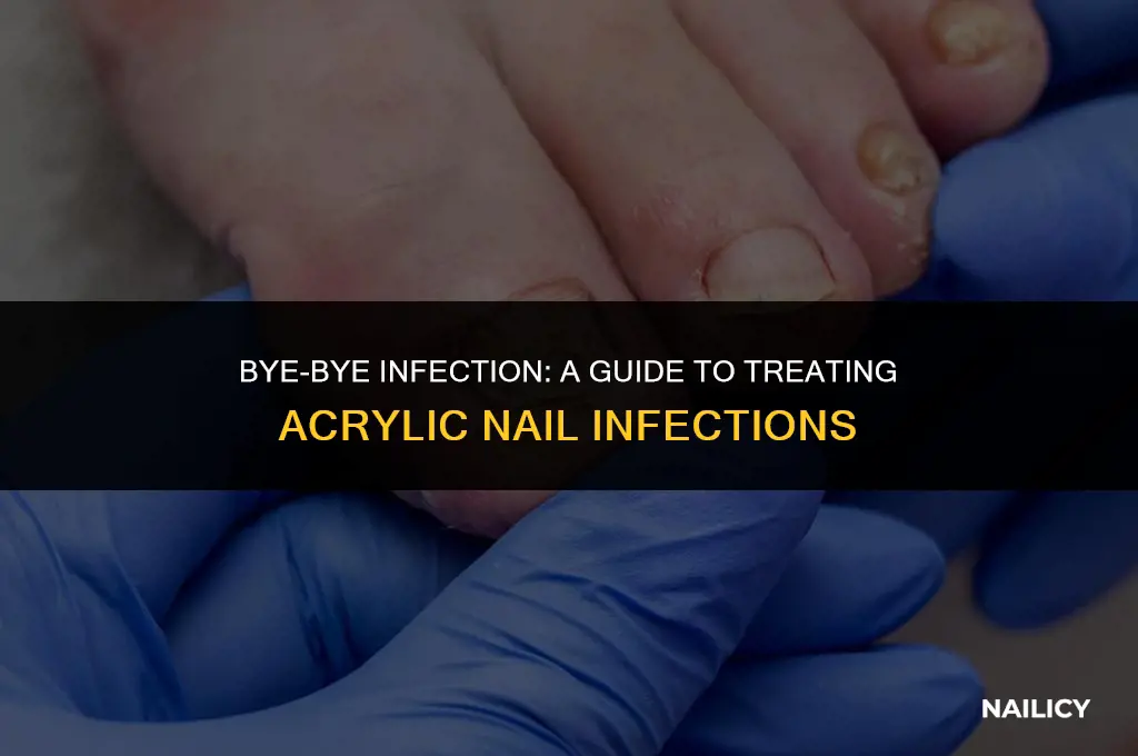how do you get rid of an infected acrylic nails