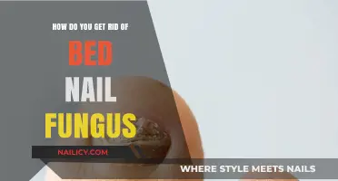 Effective Ways to Eliminate Bed Nail Fungus for Good