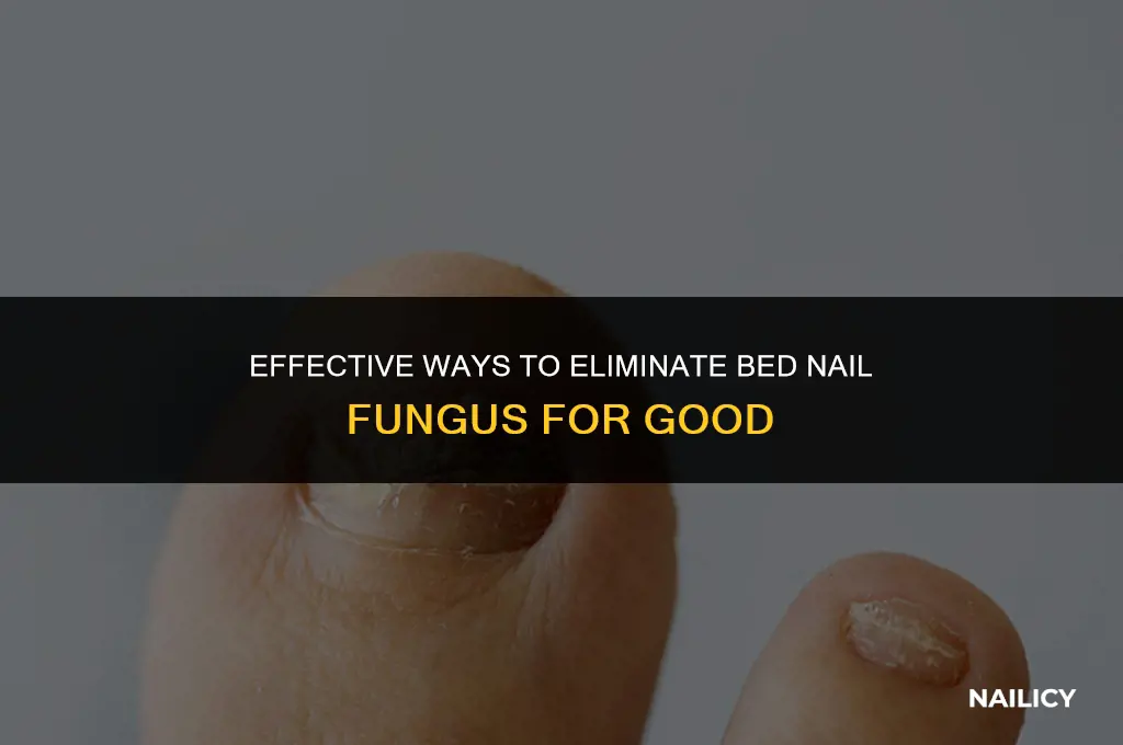 how do you get rid of bed nail fungus