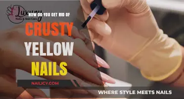 Revitalize Your Nails: A Guide to Eliminating Crusty Yellow Nails