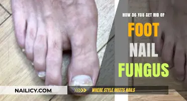Effective Ways to Eliminate Foot Nail Fungus Permanently