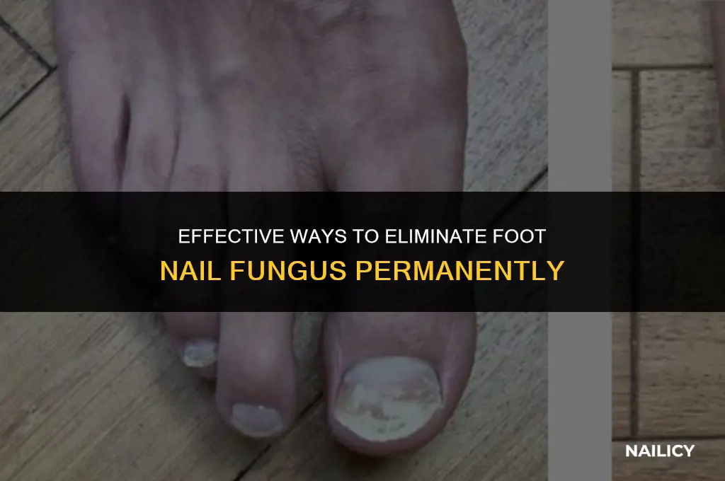 how do you get rid of foot nail fungus