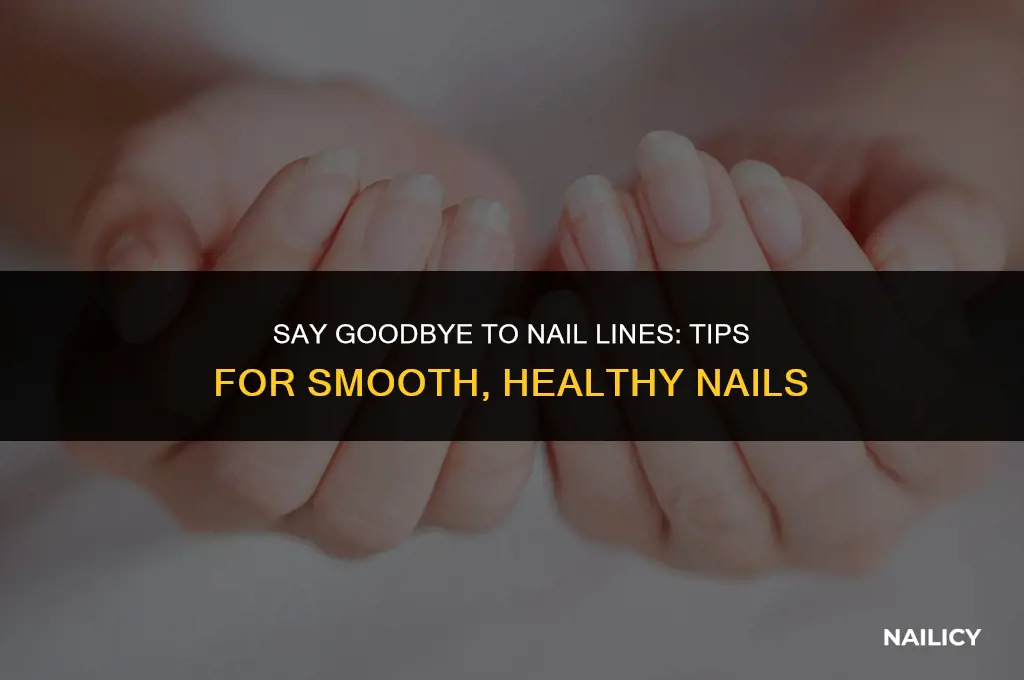 how do you get rid of lines on nails