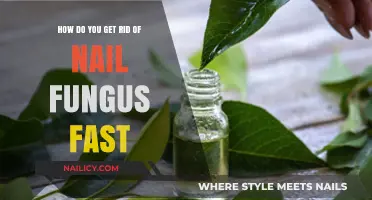 Banish Nail Fungus Quickly: Effective Remedies Revealed