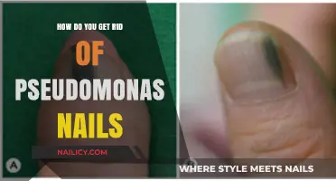 Effective Ways to Treat and Prevent Pseudomonas Nail Infections