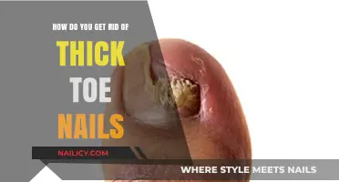 Banish Thick Toenails: Effective Remedies for Healthier Feet