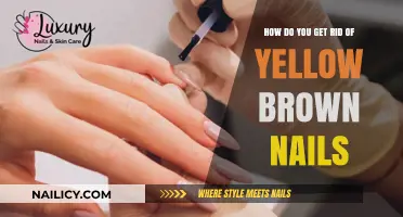 Revitalize Your Nails: A Guide to Eliminating Yellow-Brown Discoloration