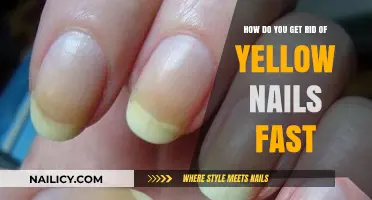 Banish Yellow Nails: Quick and Effective Remedies for a Brighter Smile