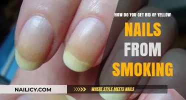 Bid Farewell to Yellow Nails: A Guide to Reversing Smoking Stains