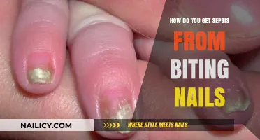 The Hidden Danger of Nail Biting: Sepsis Risk Explained