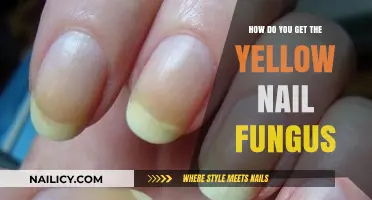 Understanding and Treating Yellow Nail Fungus: A Comprehensive Guide