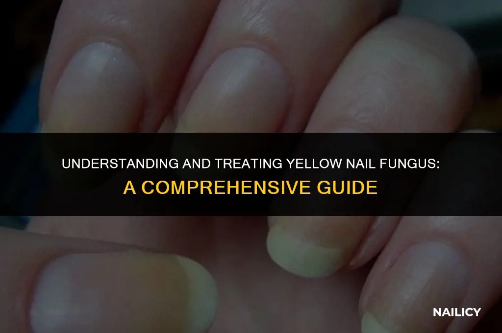 how do you get the yellow nail fungus