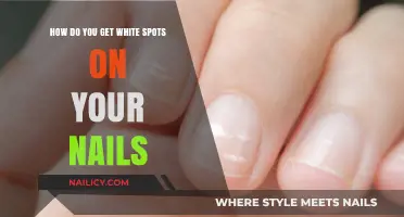 Understanding White Spots on Nails: Causes and Treatments
