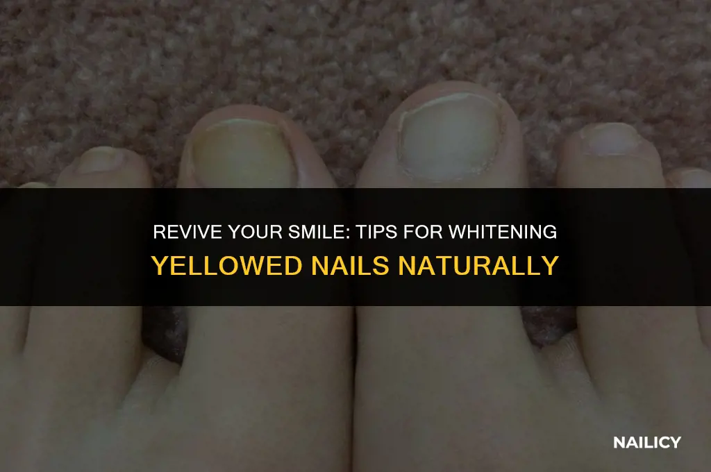 how do you get your nails white again