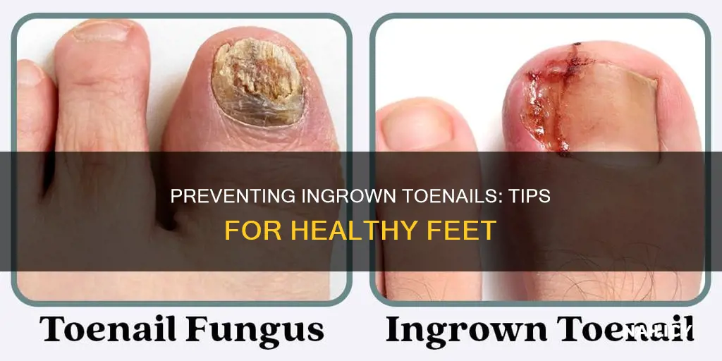 how do you keep toe nails from growing into skin
