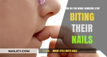 Stop Nail Biting: Effective Strategies to Break the Habit
