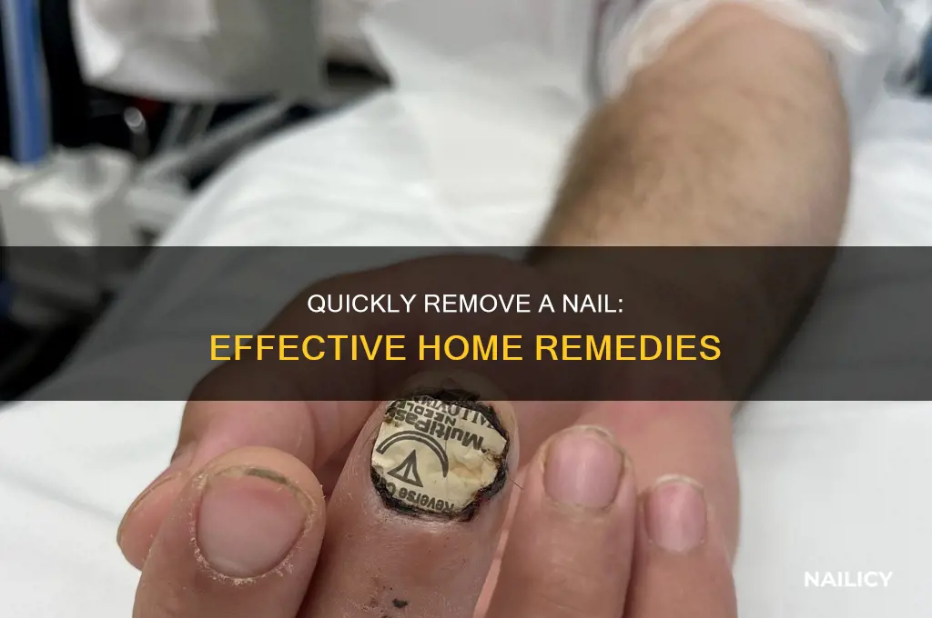 how do you make your nail fall off faster