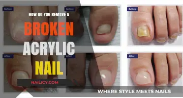 Quickly Remove Broken Acrylic Nails at Home