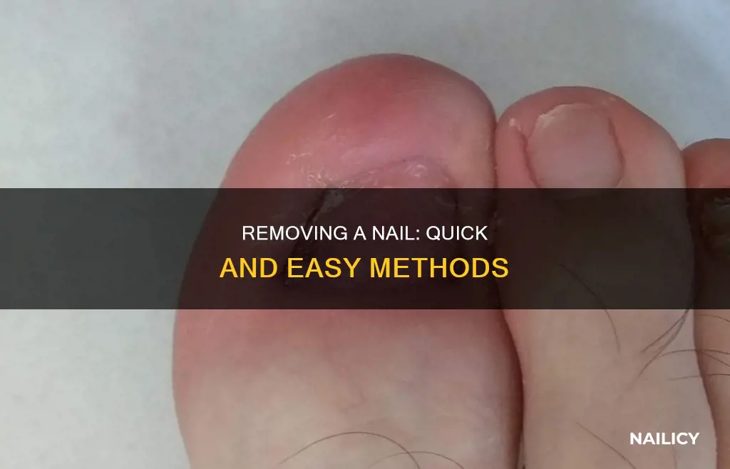 how do you remove a nail